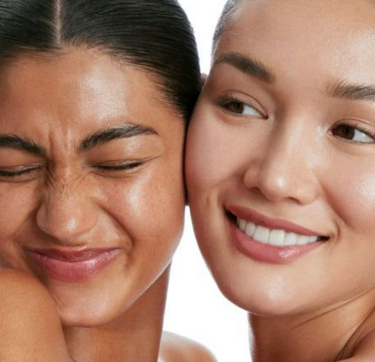 Rosacea: wat is het, hoe herken je het en wat helpt écht?